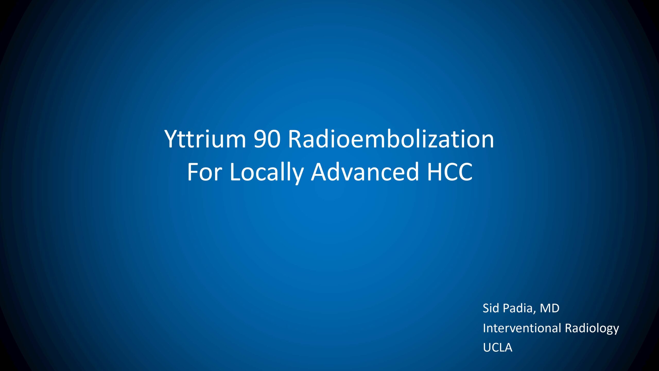 Y90 in locally-advanced disease with PVT